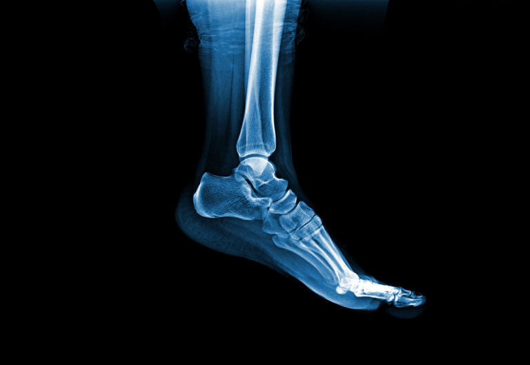 X-ray image of a foot for cyber alchemy case study